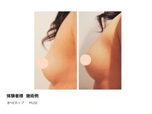 アップオー 天神大名店(up O)/