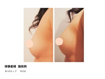 アップオー 天神大名店(up O)/