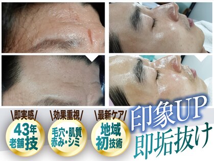 ビューティーリバース FORMEN 東戸塚店の写真