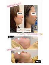 クレール 小山店(CLAIR)/【二重あご・むくみ改善】