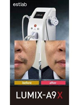 トッコ 清澄白河店(tocco)/脱毛