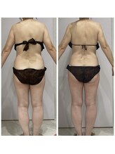 ルポーゼ(Repose)/