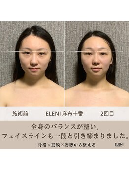 エレーニ 麻布十番(ELENI)/姿勢から整え【港区/麻布十番】
