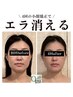 【癒しのオイルケア】小顔頭蓋骨矯正＋オイルケア¥9900→¥8400(所要時間60分)
