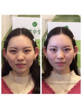 健幸堂 本店/小顔矯正1回