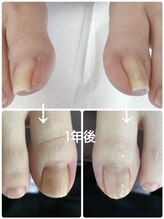 フロー(Froh)/前の画像の上から見た画像です