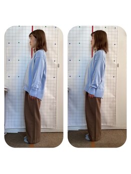 ハンズ治療院 東中野院/「姿勢矯正の症例」