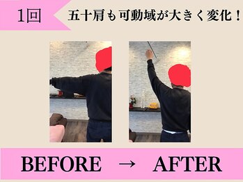 やさしい整体院 神辺店/肩の可動域が大きく変化。