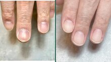 アンドアールネイルズ(and..R nails)