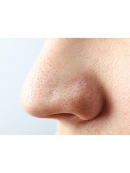 毛穴ケアをしたい