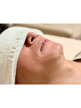 全身脱毛コースのあるサロン