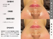 ルディラ 大宮店/スポットフィット