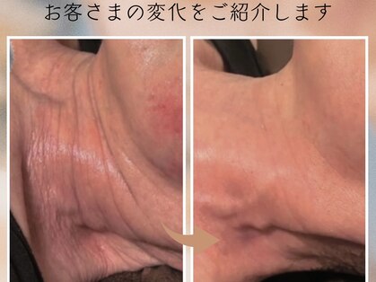 トータルスキンケア 美容ルーム(美容Room)の写真