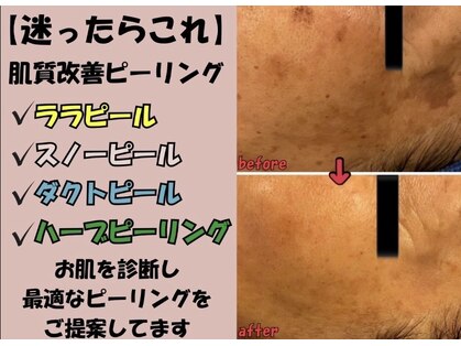 オンリーホープ(ONLY HOPE)の写真