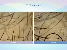 アンス(anth:)/お客様の仕上がり