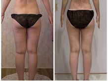 ルポーゼ(Repose)/