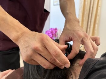 あおき鍼灸整骨院/鍼施術