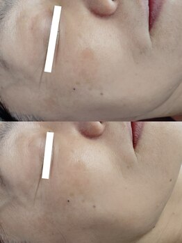 ビーユー(Be.you)/元気のないお肌を元気にしたい…