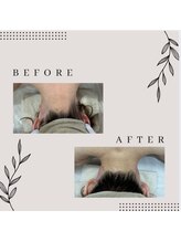 ココポキ 岐阜店/全身美肌脱毛