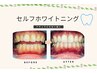 【ナチュラルな白い歯へ】即効果あり！セルフホワイトニング体験