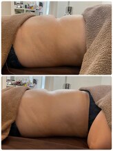 ミニマル(minimal)/骨盤調整×HOT腸もみ