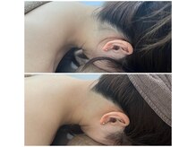 ミース 京都駅前店/うなじビフォーアフター