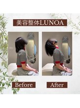 ルノア 梅田院(LUNOA)/圧倒的変化の美容整体[梅田]