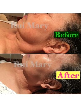 ルイマリー(Rui Mary)/すぐ小顔！フェイシャルメニュー