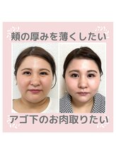 ビューティスタジオＫ/1回で、年齢を巻き戻す小顔矯正