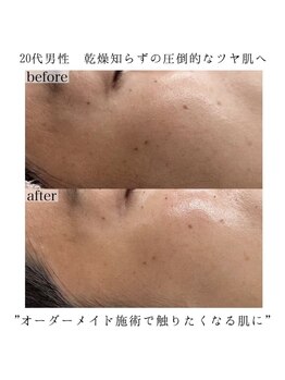 ヴェルシック(Belchic)/肌の乾燥が気にならなくなった