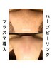 【背中のニキビケア】背中プラズマ導入ｘハーブピーリング◎挙式前OK