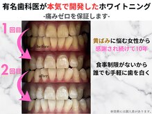 ホワイトニングショップ くずは店