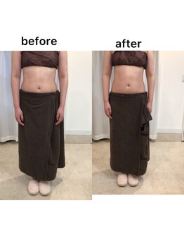 ジョワイユ(Joyeux)/腸の位置でお腹は変わる