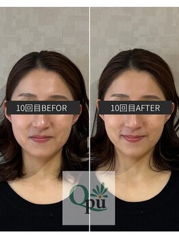 キュープ 富士店(Qpu)/回数を重ねるだけ、、！