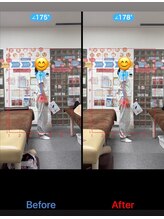 サンライズ鍼灸整骨院 淀屋橋院/猫背矯正