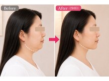 ボディステップ(BODY STEP)/整体で叶える自然な小顔