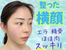 ナチュラルビューティーフェイス 横浜(NBF)