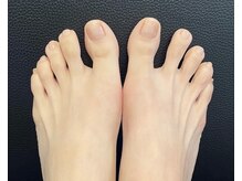 エスコート(eScort)の雰囲気（ペディキュア有。ポリッシュ対応可。ネイルケア有。）