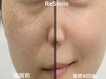 リスマイル 船橋(Re Smile)