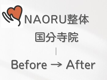 ナオル整体 国分寺院(NAORU整体)/NAORU整体国分寺　Before　After