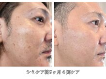 ビィーチェ(VIECE)/男性も◎