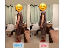 たすき鍼灸治療院/運送業60代　腰痛