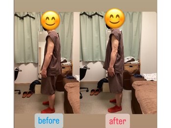 たすき鍼灸治療院/運送業60代 腰痛