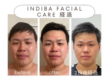 パリワール(pariwar)/インディバ*ビフォーアフター