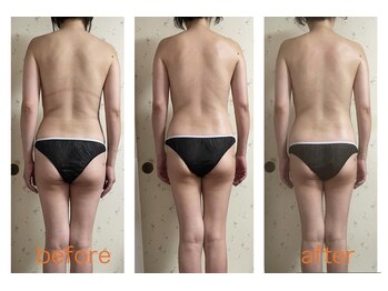 ラレコルト/ビフォーアフター