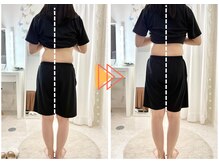 ラフィング(Laughing)/側湾ケア、産後全身整体