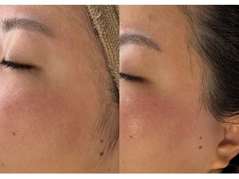 ウノ アッベリーナ(UNO × abbel'lina)/フェイシャルワックス #出雲