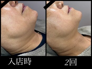 ビーエルティー(blt)/レモンボトル