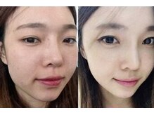 マリヴェリーテ(Mari verite)/毛穴/乾燥/艶肌/フェイシャル