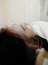 池袋ハート整体院/美容鍼☆